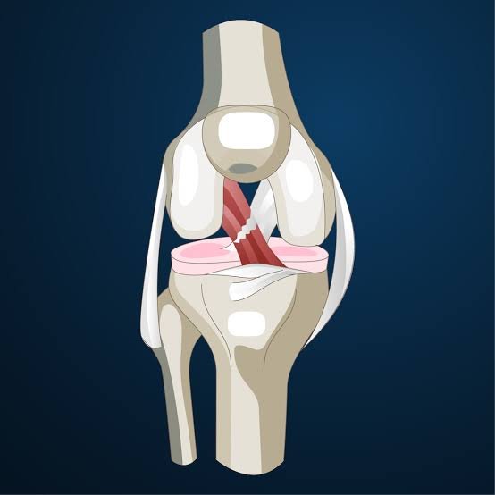 ACL Surgery In Rewa
