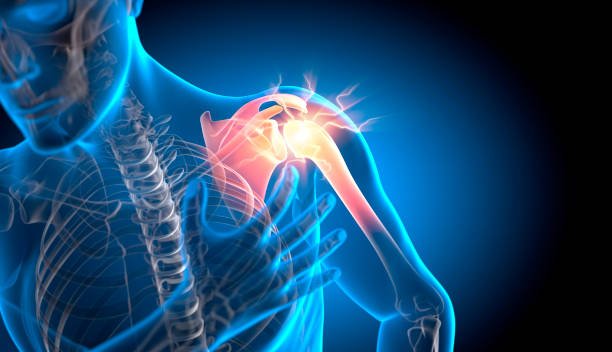 Arthroscopic Surgery In Gondia