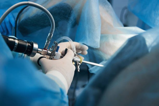 Arthroscopic Surgery In katni