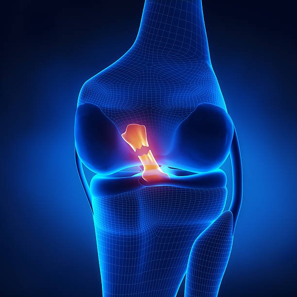 Best ACL Doctor In Gadchiroli