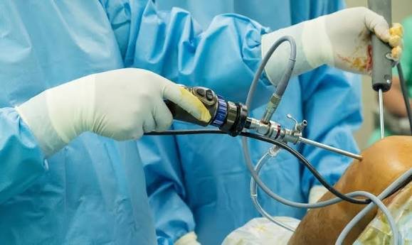 Best Arthroscopy Surgeon In Nagpur