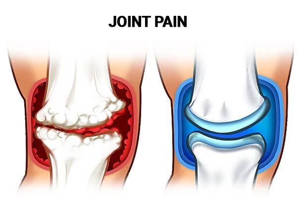 Best Joint Pain Treatment In Nagpur