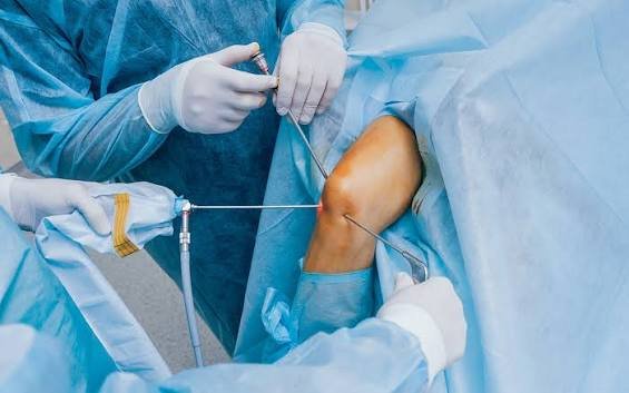 Best Knee Arthroscopy In Nagpur