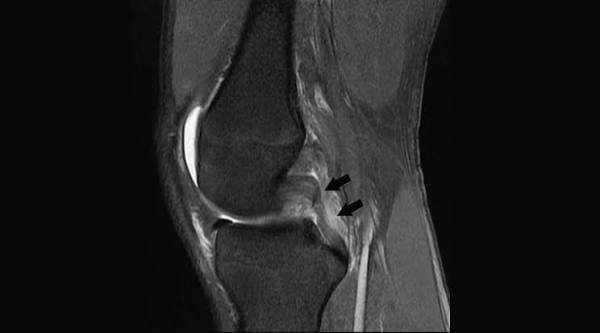 Best Knee Surgeon In Bhandara