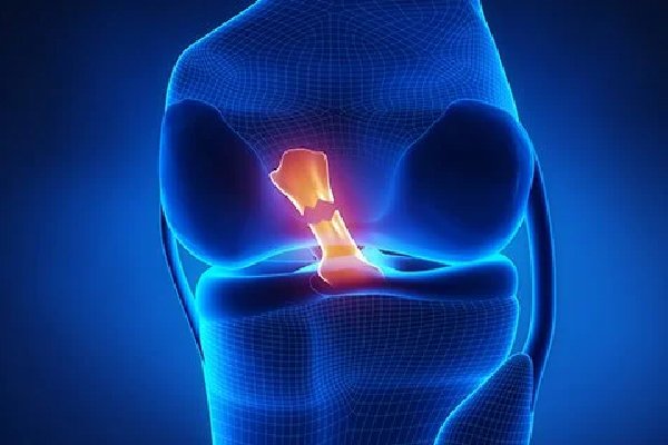 Best Ligament Doctor In Betul