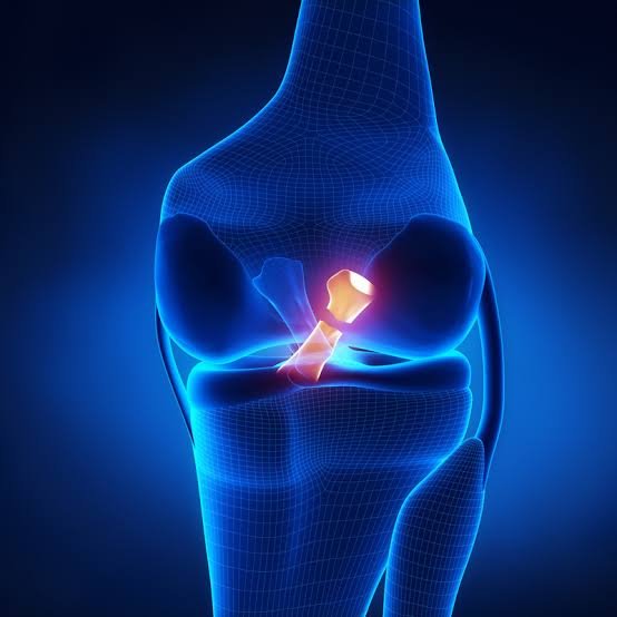 Best Ligament Doctor In Yavatmal