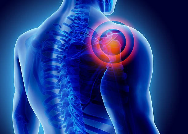 Best Shoulder Pain Doctor In Wardha