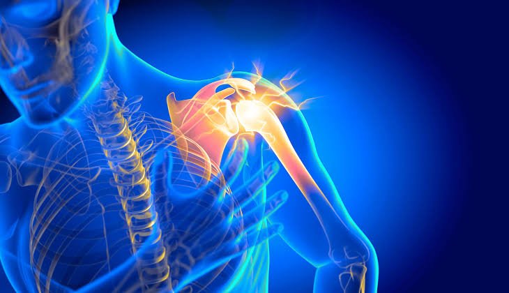 Best Shoulder Pain Doctor In Yavatmal