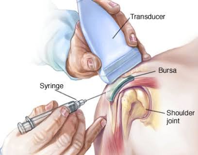 Best USG Guided Injections In Nagpur