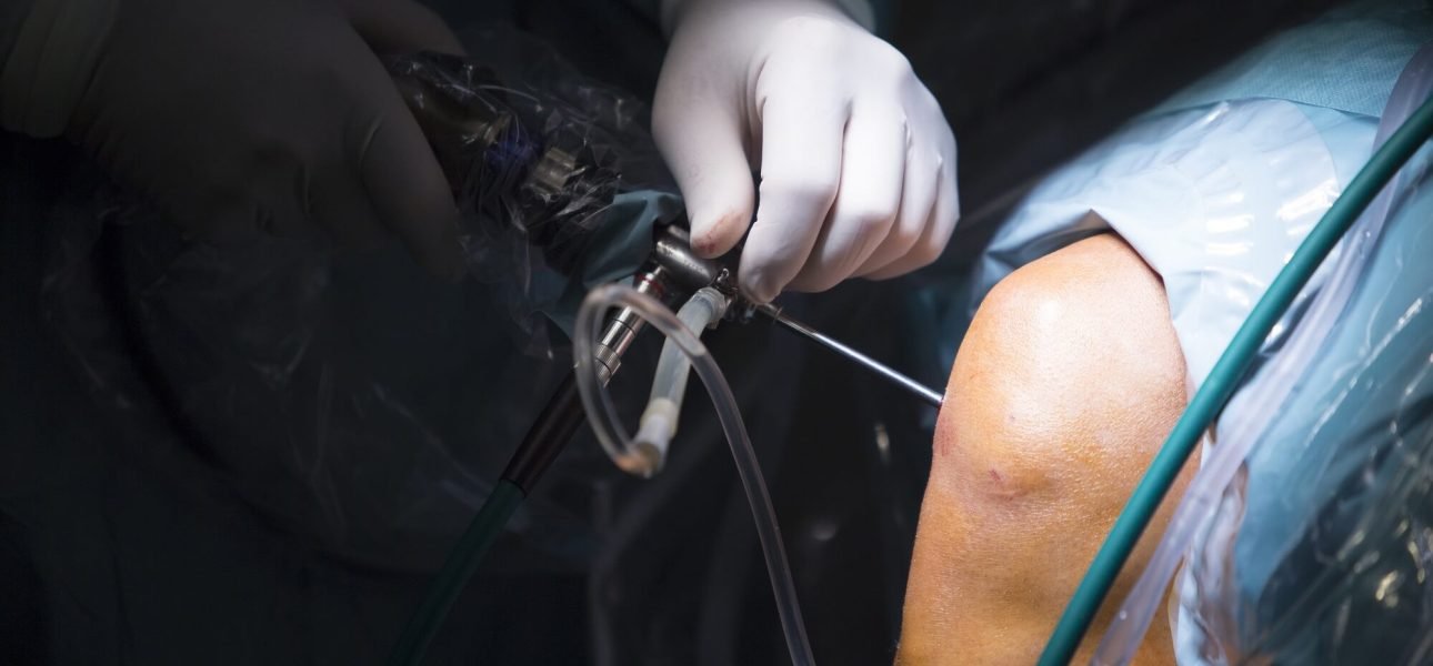 Best knee Surgeon In Nagpur