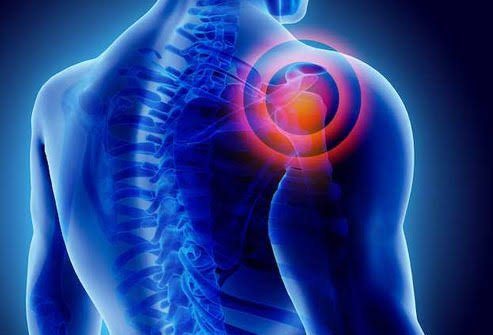 Frozen shoulder Treatment In Nagpur