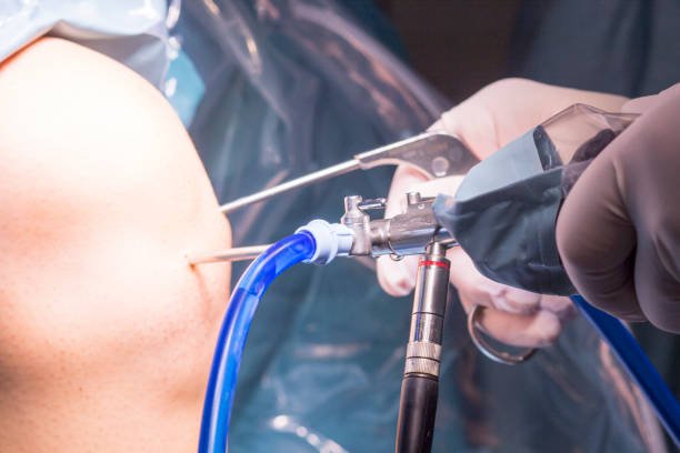 Knee Arthroscopy Surgery In Nagpur