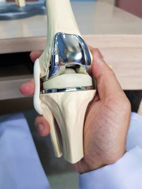 Knee Replacement Surgery In Rewa