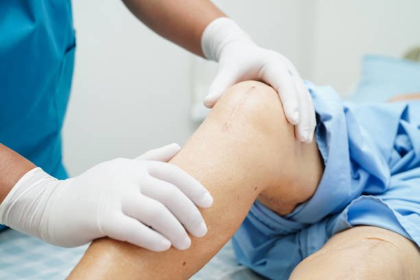 Knee Replacement Surgery In Yavatmal