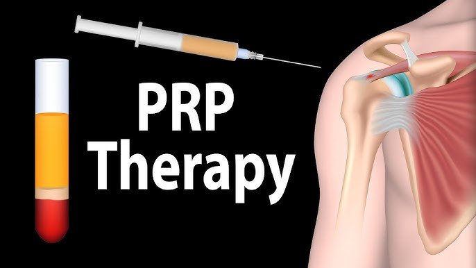 PRP Injection In Nagpur