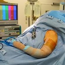 Shoulder Arthroscopy In Balaghat