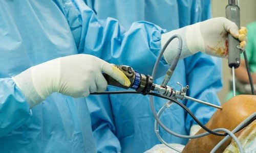 Shoulder Arthroscopy In Bhandara