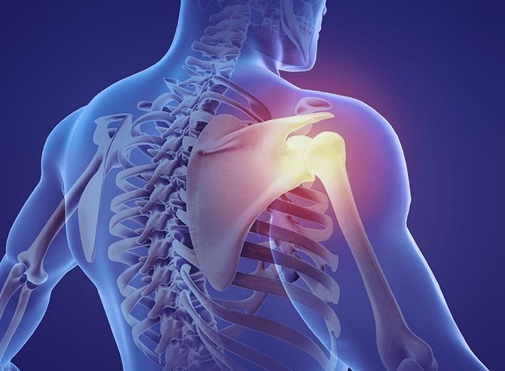 Shoulder Arthroscopy In Sagar