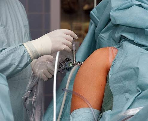Shoulder Arthroscopy In Wardha
